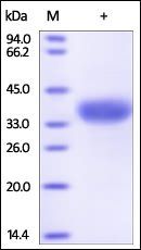 Human Angiopoietin-like 4 / ANGPTL4 (166-406) Protein