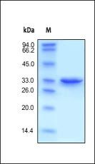Human Annexin A5 Protein