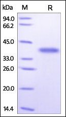 Human Arginase 1 Protein, His Tag