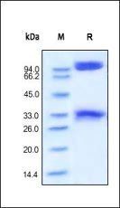 Human BACE-1 Protein, Fc Tag