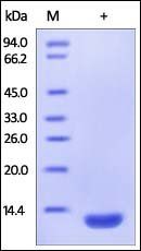Human beta 2-Microglobulin Protein, His Tag