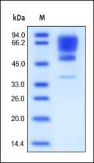 Human CADM1 Protein, His Tag