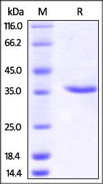 Human Carbonic Anhydrase IX / CA9 (138-414) Protein [Out of stock]