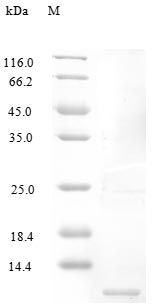 Human CCL14 protein (Active)