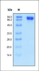 Human MCAM Protein, His Tag