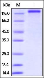Human CD163 Protein, His Tag