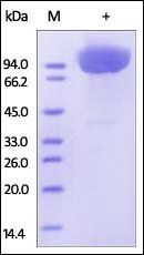 Human CD31 Protein, His Tag