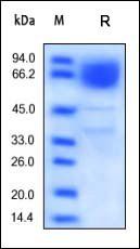 Human CD36 Protein, His Tag