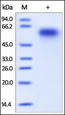 Human CD46 Protein, His Tag