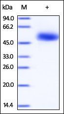 Human CD5 Protein, His Tag, low endotoxin