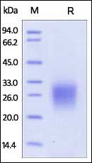 Human CD74 Protein, His Tag