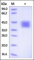 Human CD84 Protein, His Tag