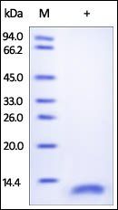 Human CD9 Protein, His Tag