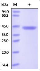 Human Chitinase 3-like 1 / CHI3L1 Protein