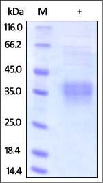 Human Clusterin Protein, His Tag