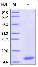 Human Cystatin S / CST4 Protein