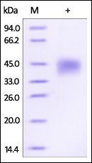 Human Dkk-1 Protein, His Tag
