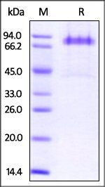 Human Dkk-1 Protein