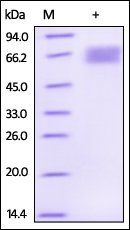 Human Dkk-3 Protein, His Tag