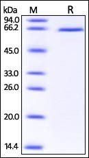 Human DLL1 / Delta1 Protein