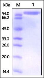 Human DPPIV Protein