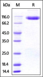Human DPPIV Protein, His Tag