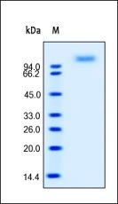 Human E-Selectin Protein, His Tag