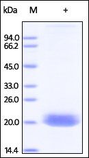 Human Ephrin-A4 Protein, His Tag