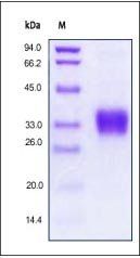 Human Erythropoietin / EPO Protein