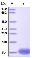 Human FABP1 Protein, His Tag