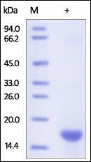 Human FABP5 Protein, His Tag