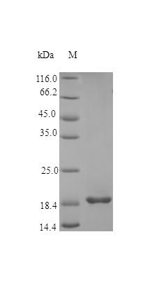 Human FGF21 protein (Active)