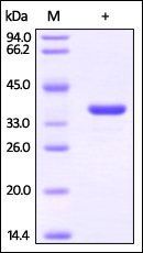 Human GAPDH Protein, His Tag