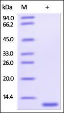 Human Glutaredoxin 1 Protein, His Tag