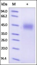 Human Growth Hormone R Protein, His Tag