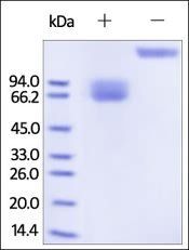 Human Growth Hormone R (GHR) Protein