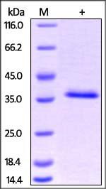 Human HABP1 Protein, His Tag