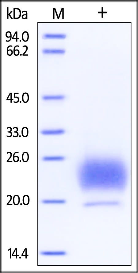 Human HE4 / WFDC2 Protein