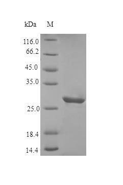 Human IBP3 protein (Active)