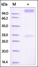 Human IFN-alpha / beta R1 Protein, Fc Tag