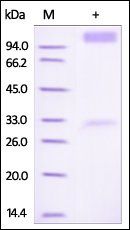 Human IFN-alpha / beta R1 Protein