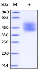 Human IFN-alpha / beta R2 Protein, His Tag