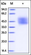 Human IFN-alpha/beta R2 Protein