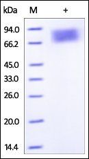 Human IFN-alpha / beta R2 Protein, Fc Tag