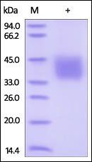 Human IFN-gamma R1 Protein, His Tag