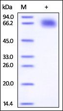 Human IFN-gamma R1 Protein, Fc Tag