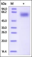 Human IL-1 RAcP Protein, His Tag
