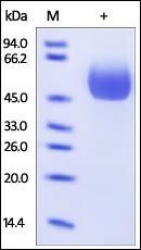 Human IL-1 RII Protein, His Tag