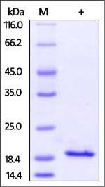 Human IL-10 Protein, His Tag