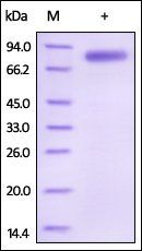 Human IL-12B Protein, Fc Tag